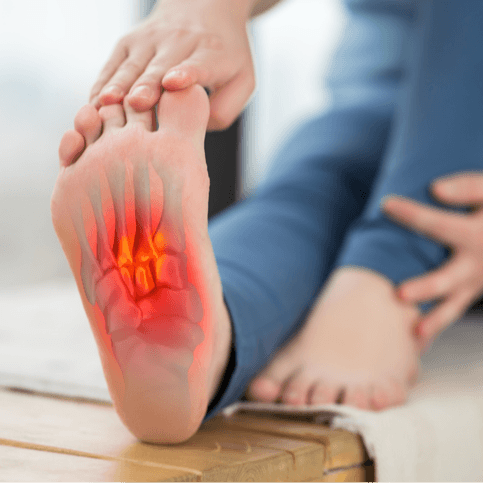 Plantar Fasciitis Treatment - Healthcare service image