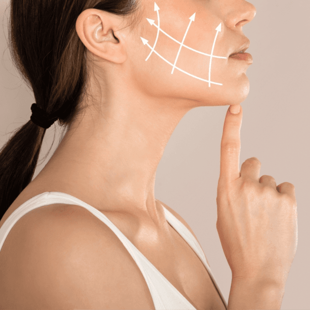 Sculptra (1 session) - Healthcare service image