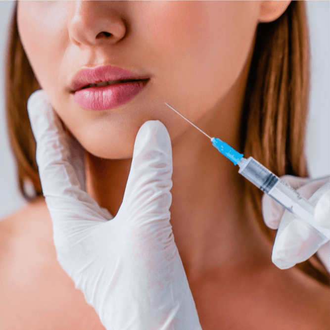 Filler Restylane (1 ml) - Healthcare service image