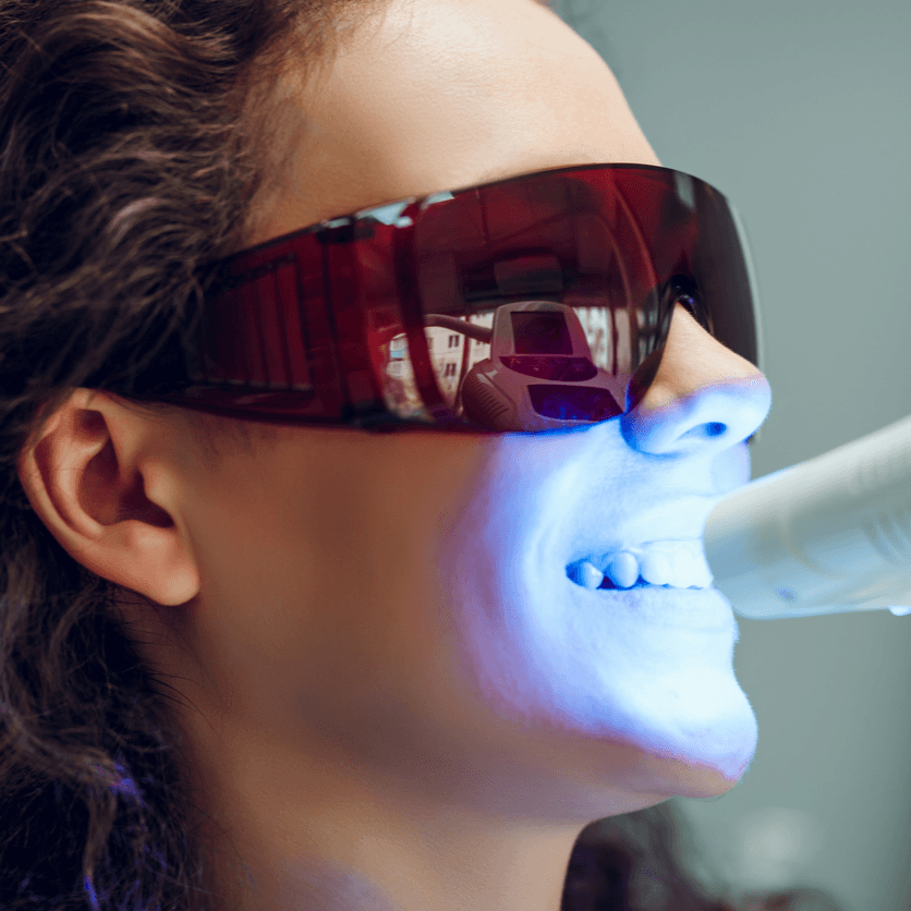 Dental Consultation + Teeth Cleaning + Whitening - Healthcare service image