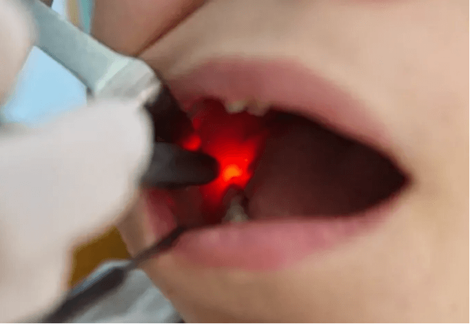  
جلسة علاج للأطفال - Healthcare service image