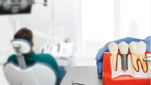 جلسة علاج قناة الجذر للأطفال - Healthcare service image