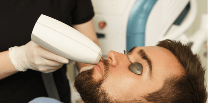 Laser Hair Removal Candela - Men (Any Body Part, including Beard) - Healthcare service image