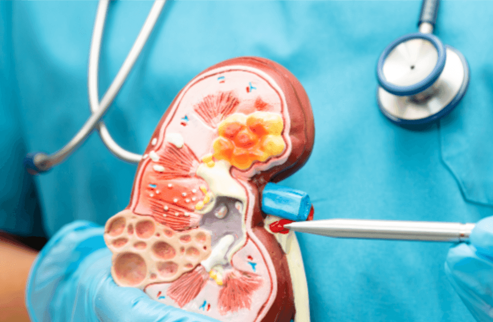 حزمة الكلى - Healthcare service image