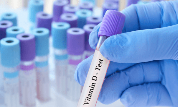 Vitamin D Package  - Healthcare service image
