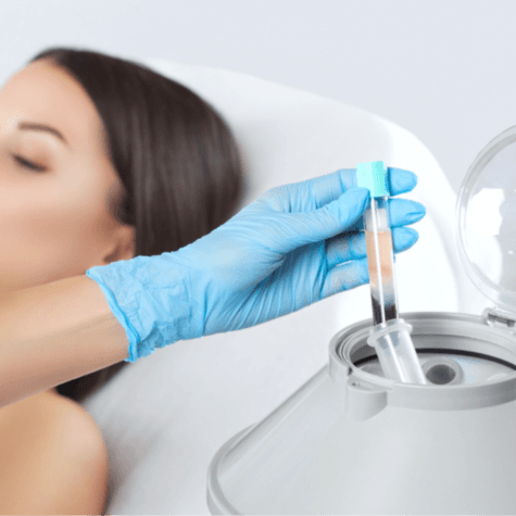 PRP with Microneedling - Healthcare service image
