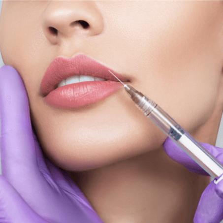 Lip Flip - Healthcare service image