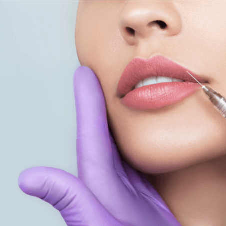 Lip Filler (Natural, Russian, Cherry) - Healthcare service image