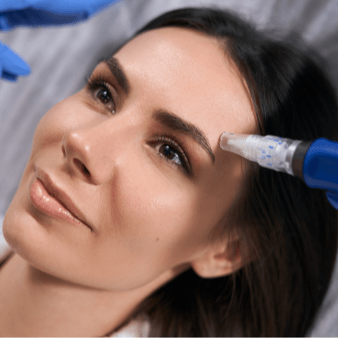 Derma Pin [السعر الابتدائي] - Healthcare service image