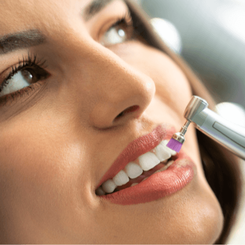 Teeth Cleaning - Healthcare service image