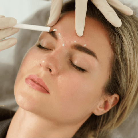 Consultation & Botox 12 Unit - Healthcare service image