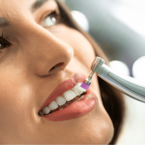 Consultation & Descaling & Polish - Healthcare service image