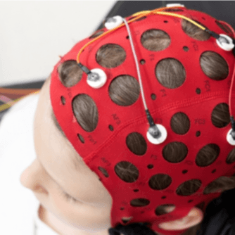 جلسة رسم خريطة الدماغ QEEG (لمدة 60 دقيقة) - Healthcare service image