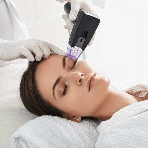Morpheus8 - Healthcare service image