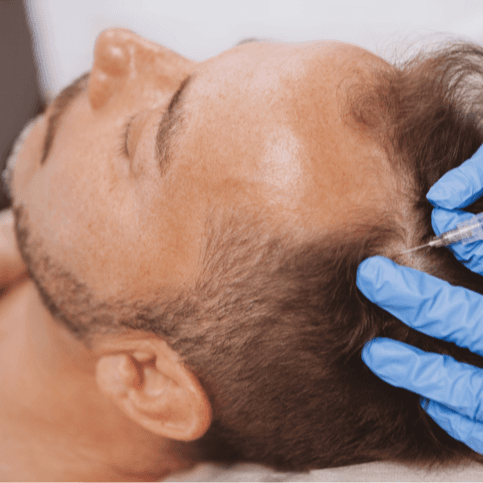 حشو الشعر - Healthcare service image