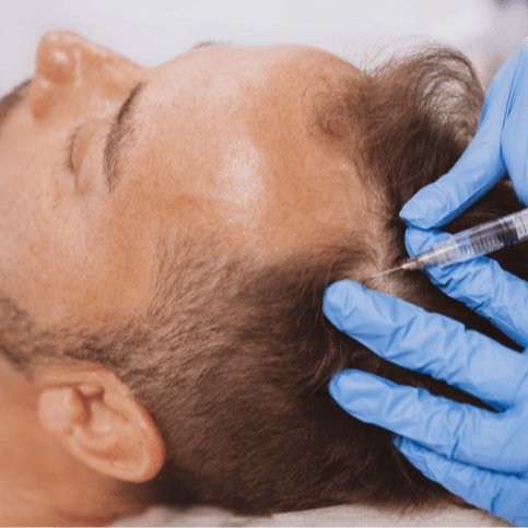 حشو الشعر - Healthcare service image