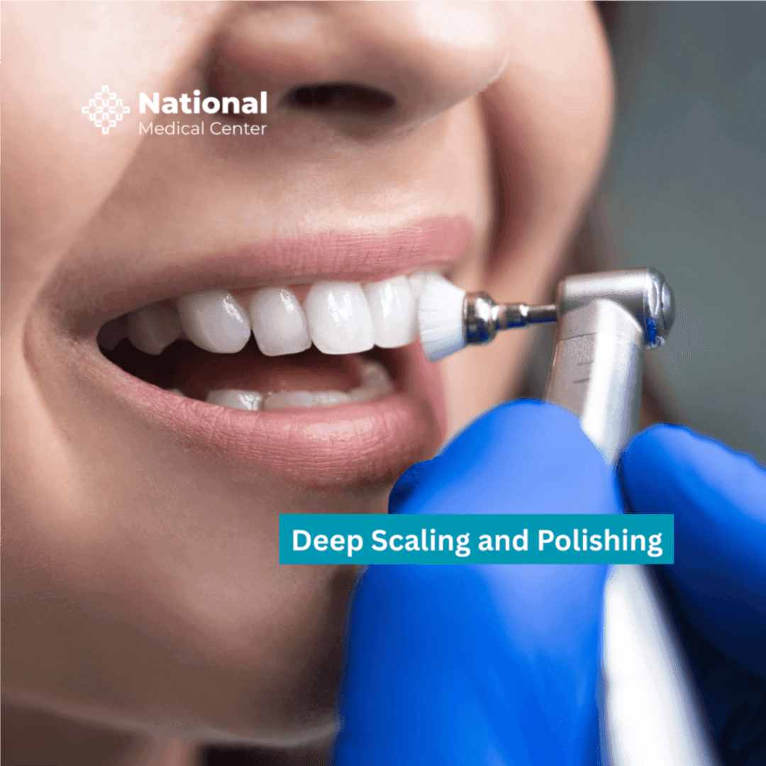 تنظيف الأسنان العميق - Healthcare service image