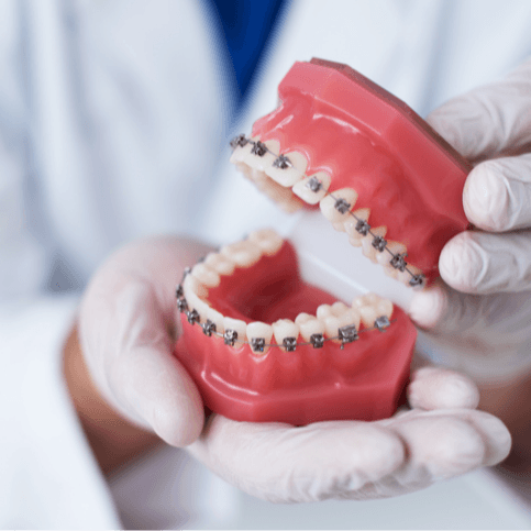  
Orthodontic Treatment - Healthcare service image