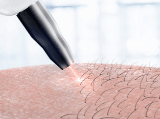  
Women Full Body 3 Sessions - Healthcare service image