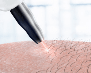  
الجسم الكامل - Healthcare service image