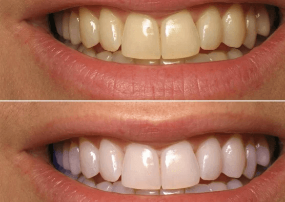  
Treatment Session - Healthcare service image