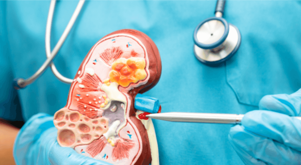  
Renal Package - Healthcare service image