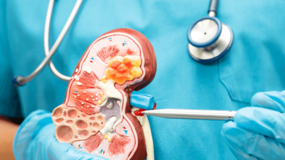  
Renal Package - Healthcare service image