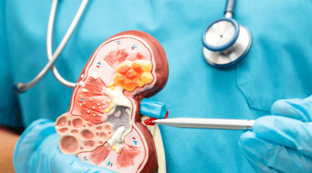  
Renal Package - Healthcare service image