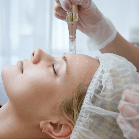  
Juliette Armand Ameson Scar Mesotherapy - Healthcare service image