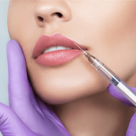  
Consultation & Lip Filler - Healthcare service image