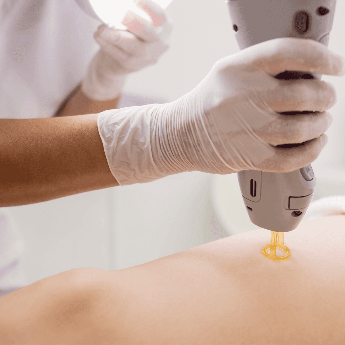  
legs - Healthcare service image