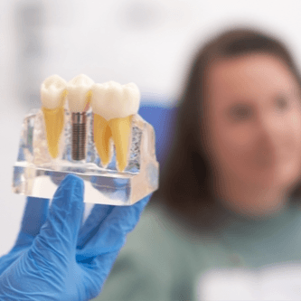  
استشارة بشأن قناة الجذر والتاج - Healthcare service image