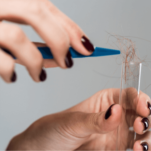  
اختبار الحمض النووي: ملف تساقط الشعر - Healthcare service image