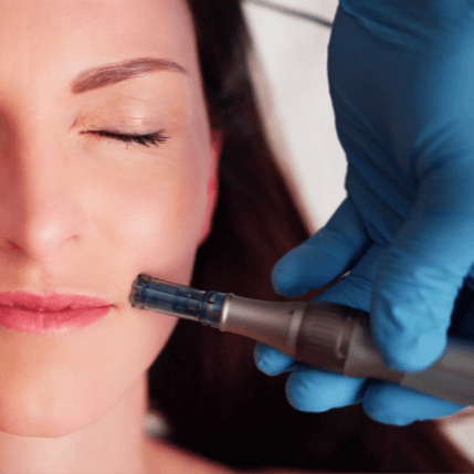  
ديرمابن [الوخز بالإبر الدقيقة] - Healthcare service image