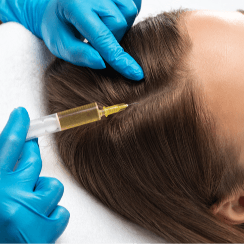  
جلسة البلازما الغنية بالصفائح الدموية (PRP) - Healthcare service image