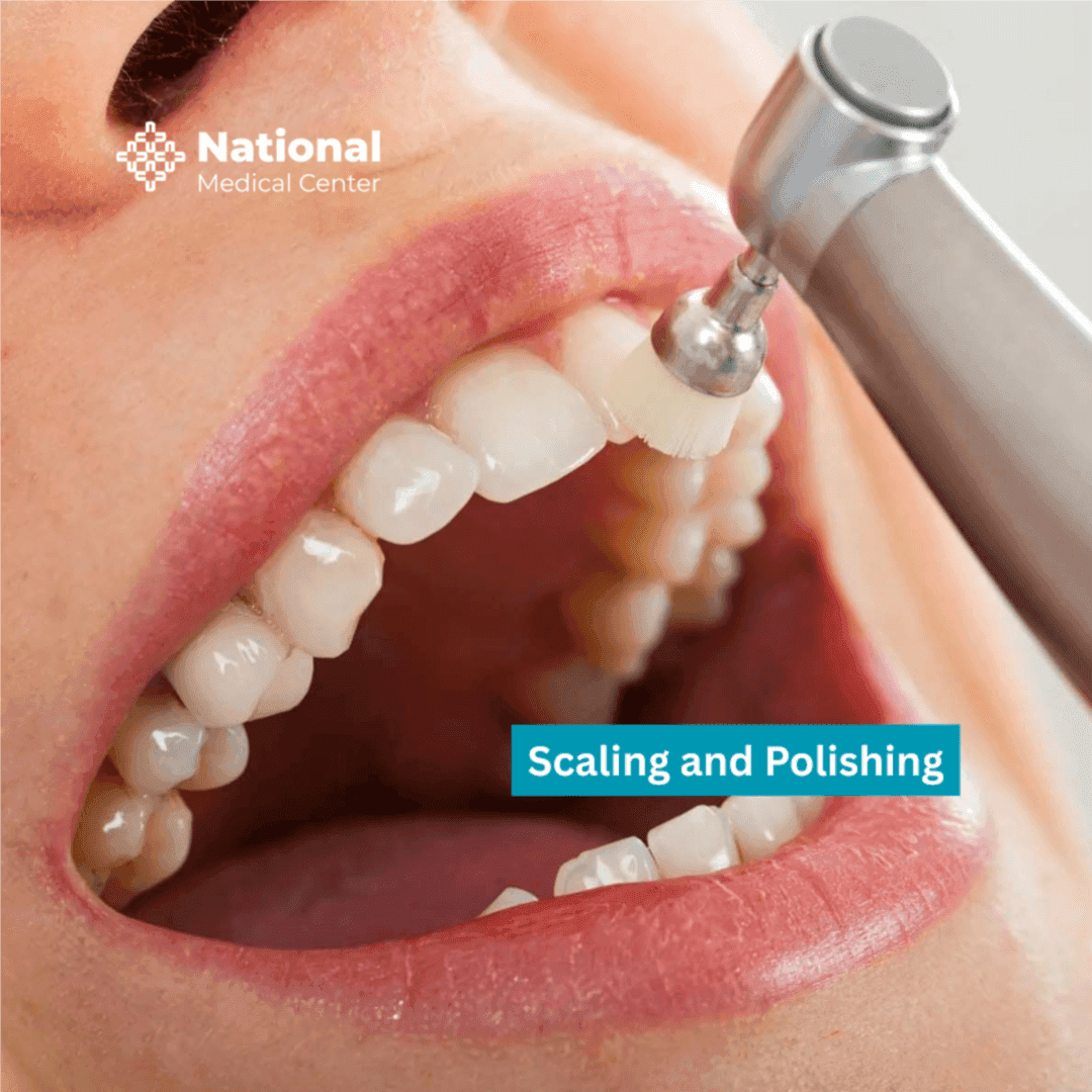  
تنظيف الأسنان الأساسي - Healthcare service image