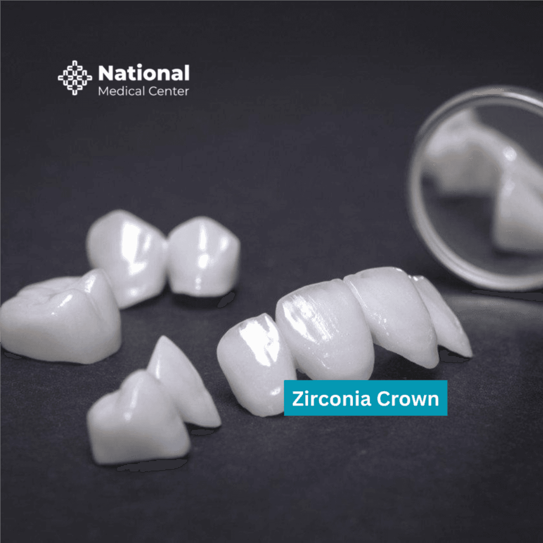  
Zirconia Crown - Healthcare service image