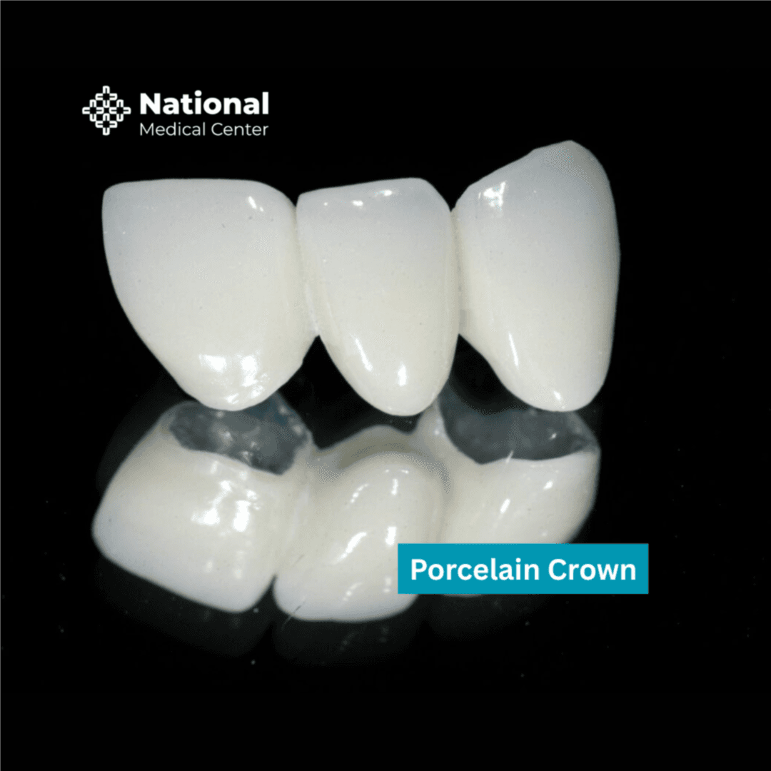  
Porcelain Crown - Healthcare service image