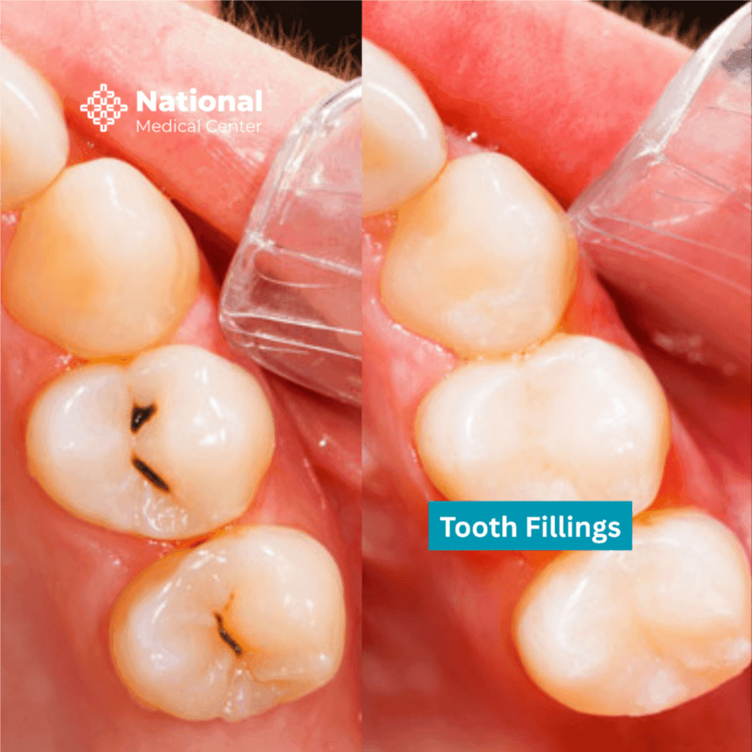  
Cosmetic Filling - Healthcare service image