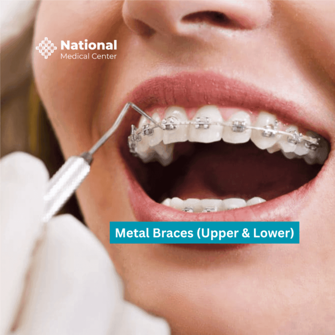  
Metal Braces - Healthcare service image