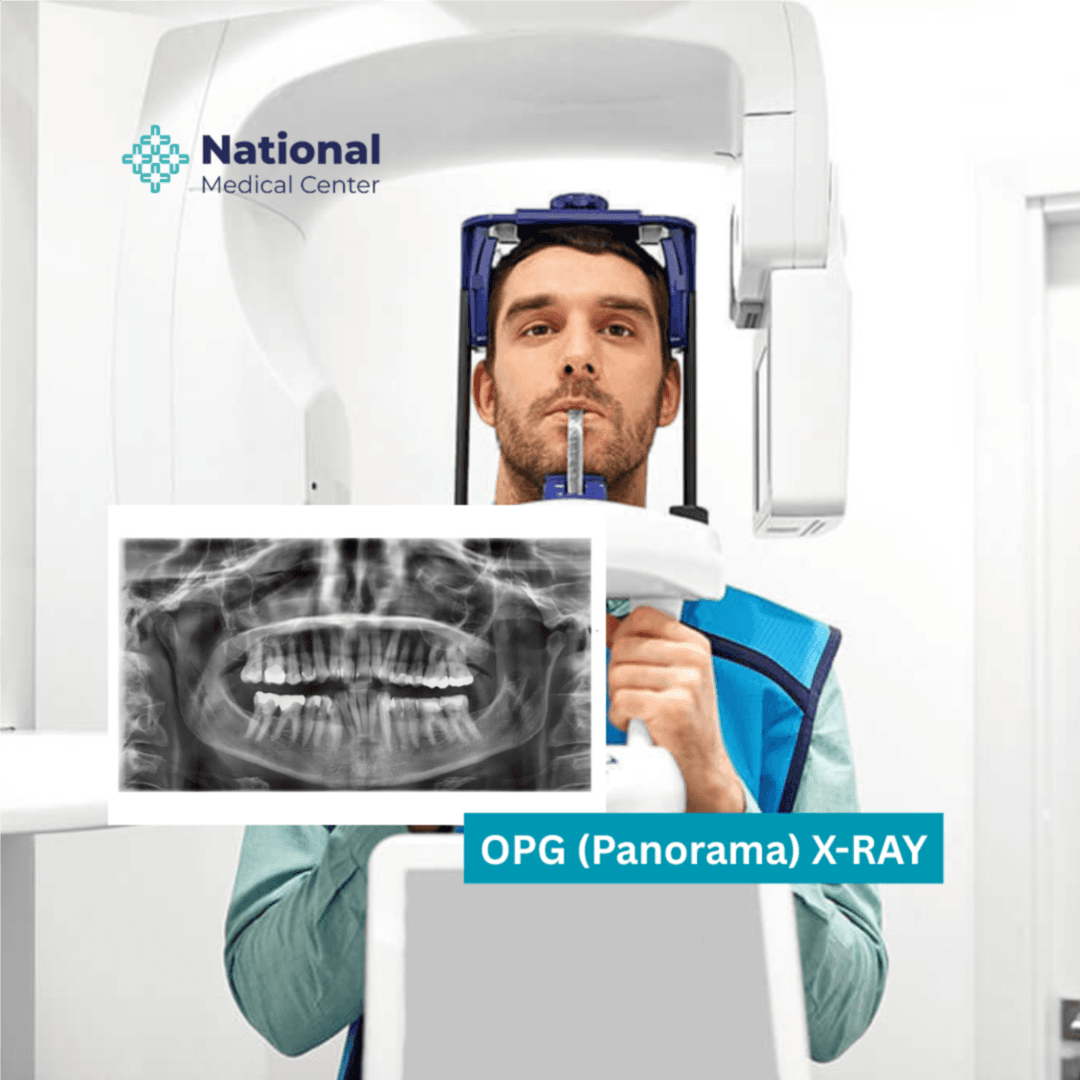  
Panoramic X-ray for the teeth (OPG X-ray) - Healthcare service image
